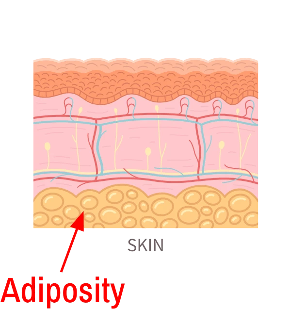 adiposity tissue